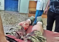 У Києві напали на колишнього захисника ДАП